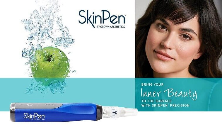 Microneedling