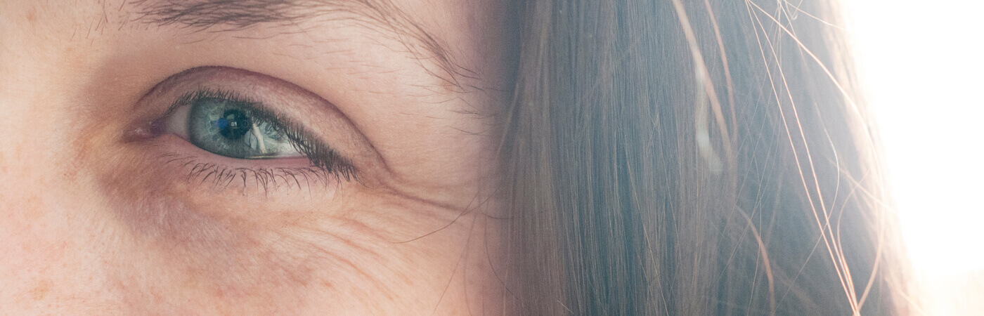 Lines and wrinkles
