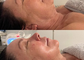 Why should you have a Skincare Consultation?