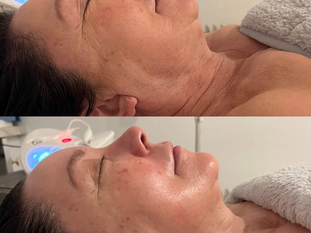 Why should you have a Skincare Consultation?